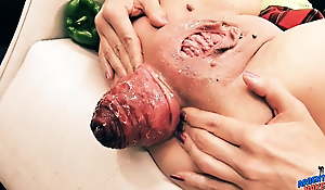 Insanely Well-known Prolapse! Cervix Exposure. Eggplant Penetratio