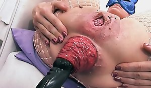 Most affecting prolapse scene! cervix, fisting, max stretch